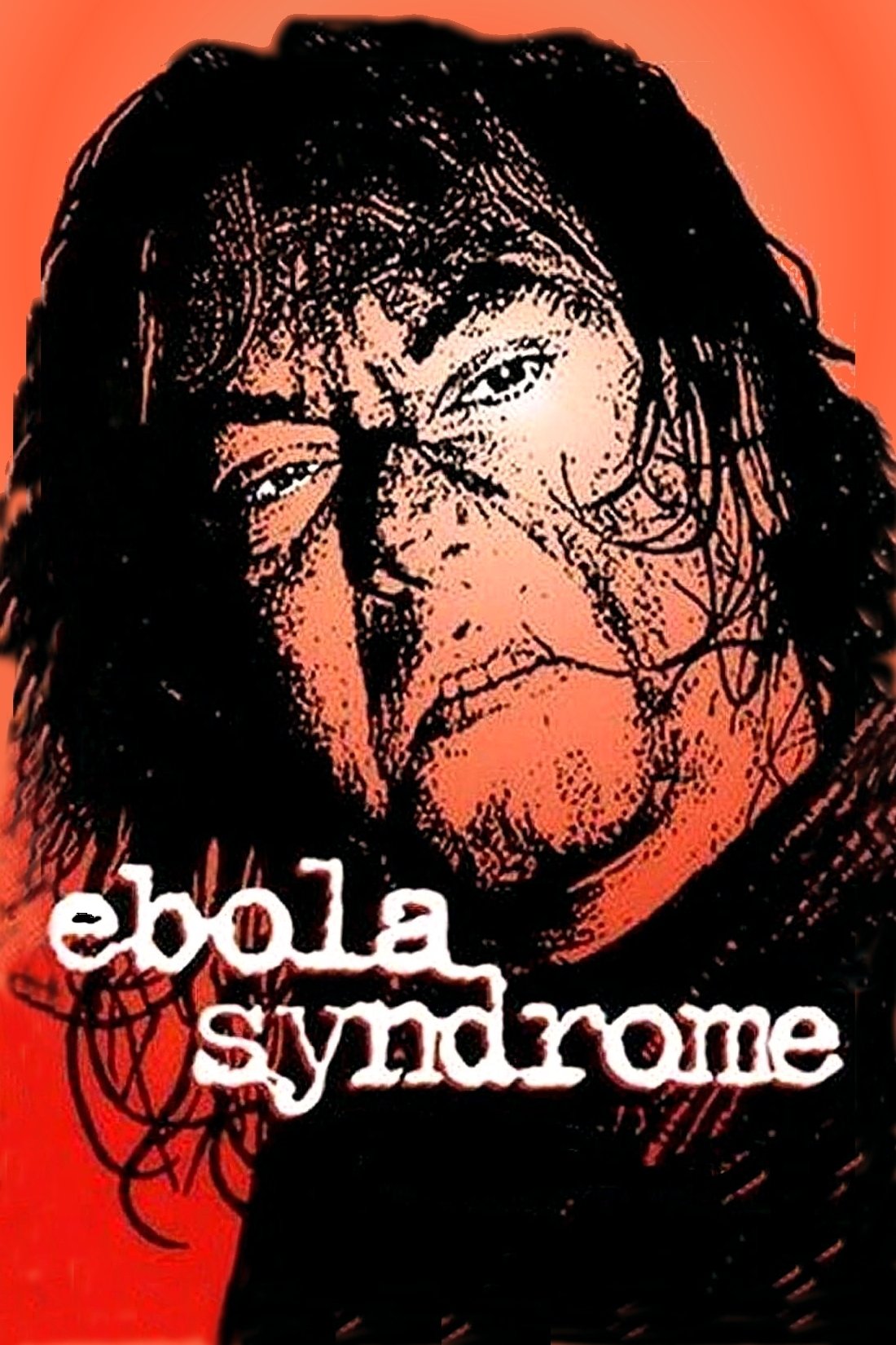 Ebola Syndrome photo