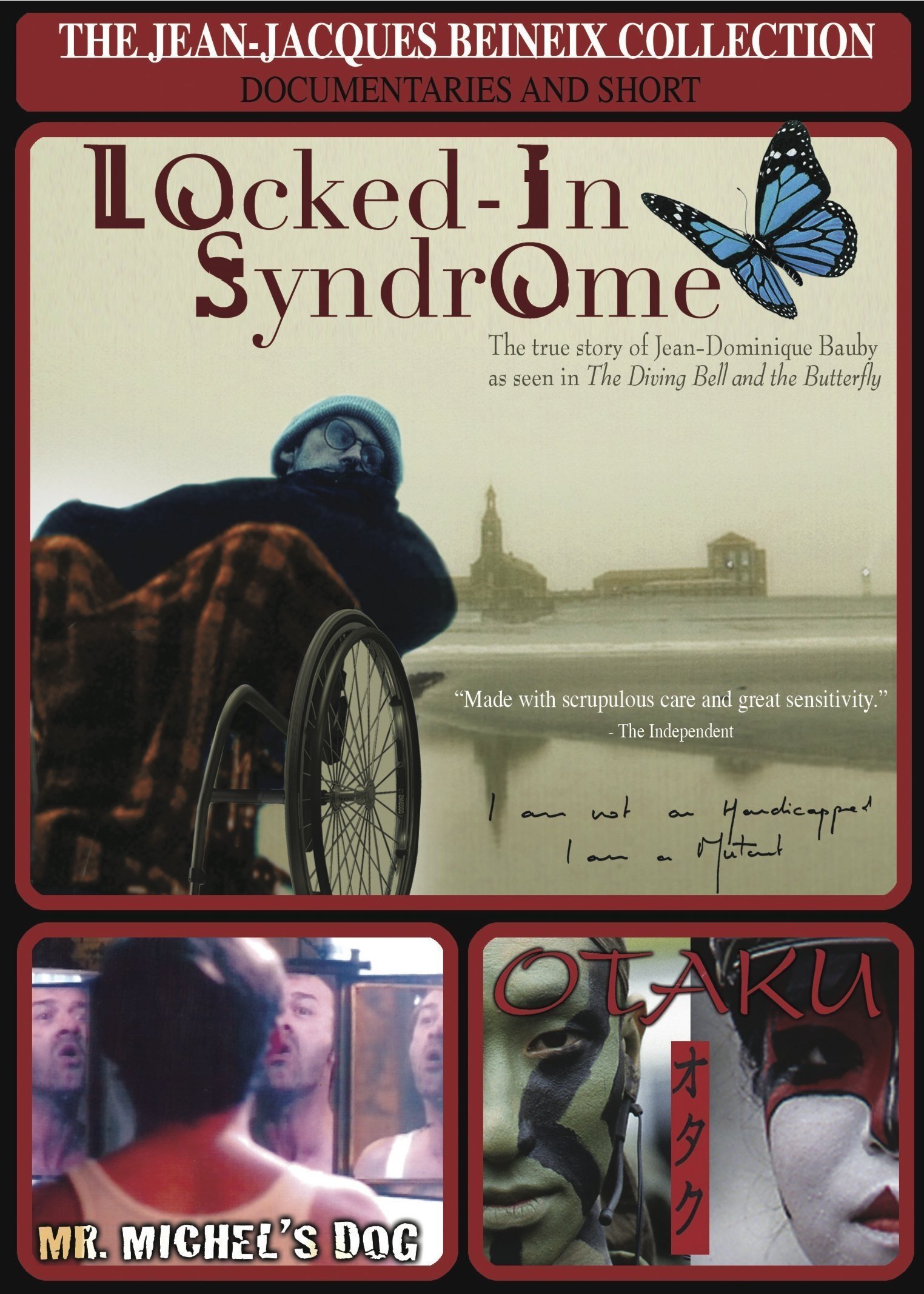 Locked-In Syndrome photo