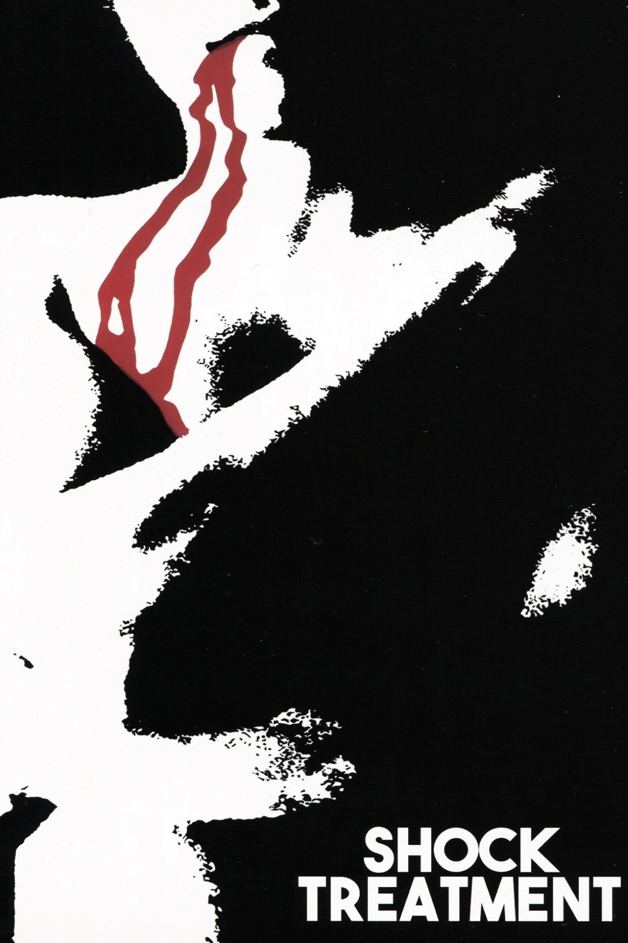 Shock Treatment photo