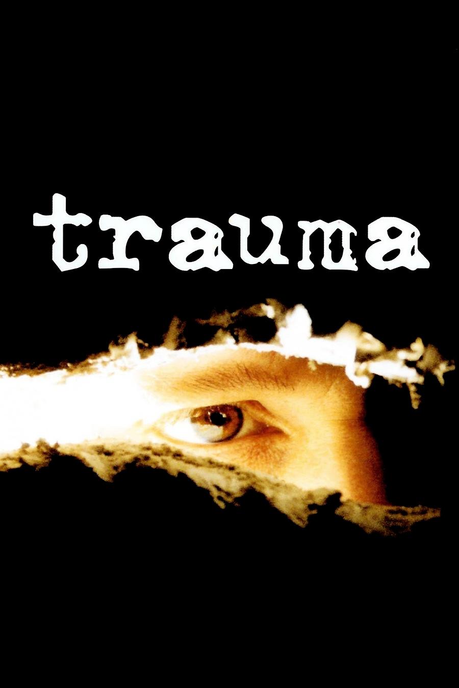 Trauma photo